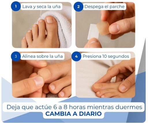 Pack 2 Cajas De Parches Hongos Uñas