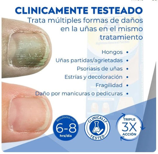 Pack 2 Cajas De Parches Hongos Uñas