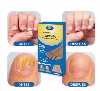 Pack 2 Cajas De Parches Hongos Uñas