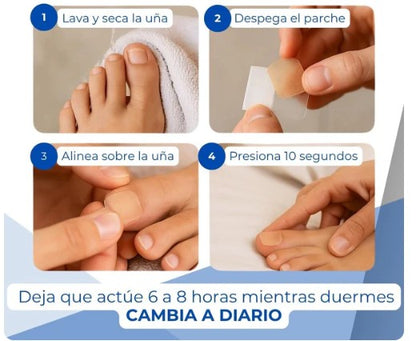 Pack 2 Cajas De Parches Hongos Uñas